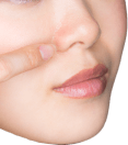 一般的な鼻形成術の豆知識